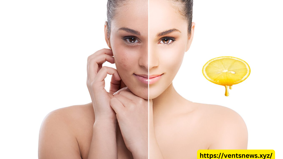 Wellhealthorganic.com : remove dark spots on face tang